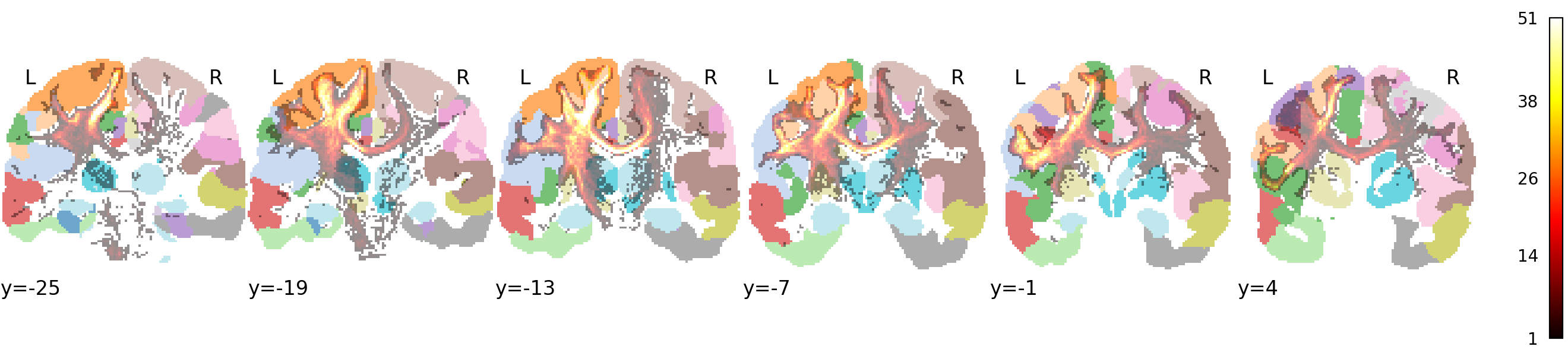 Motor bundle TDI from Glasser Left_4 and Left_6 regions