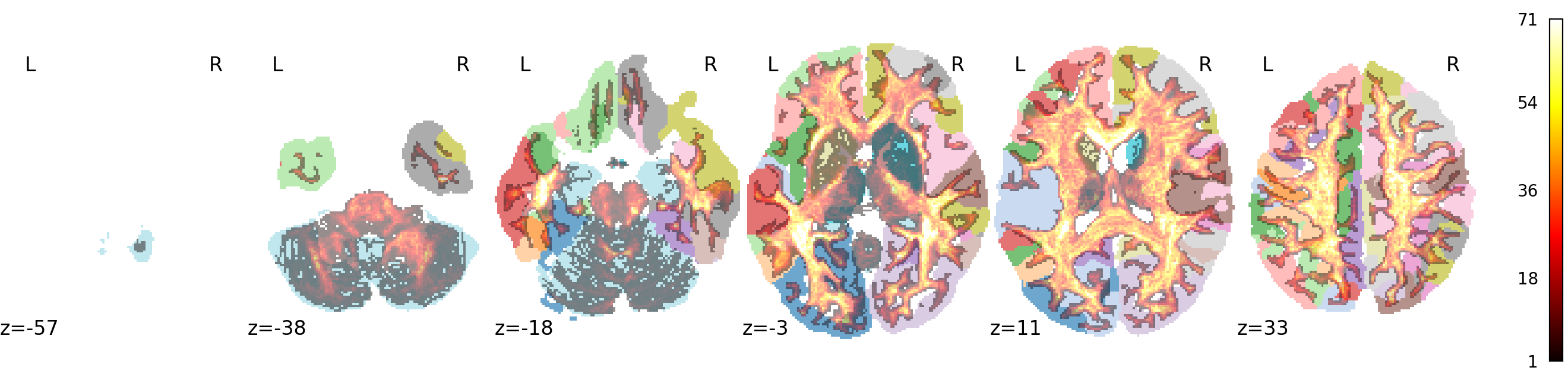 Whole-brain TDI overlaid on 4S456 parcellation atlas